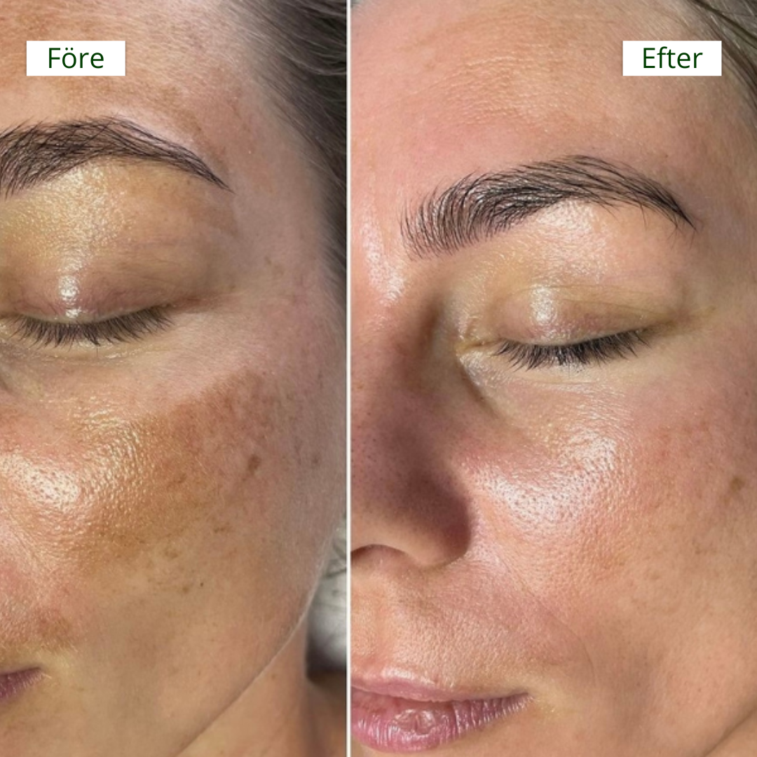 ClearBeauty Pads - Jämnare hy & återfuktning